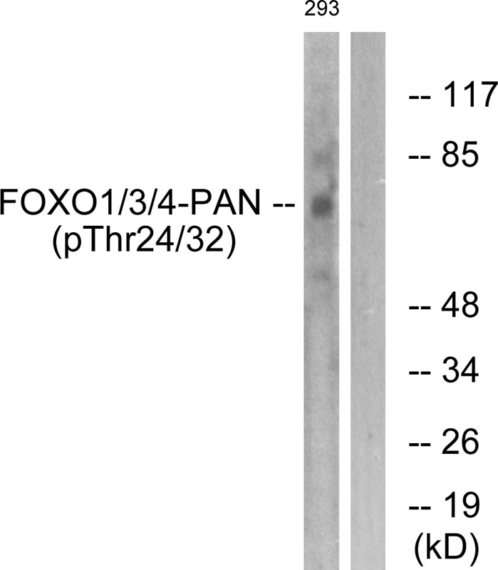 FOXO1/3/4-pan (Phospho-Thr24/32)