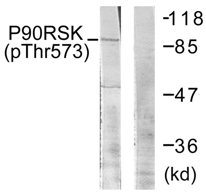 p9RSK (Phospho-Thr573)