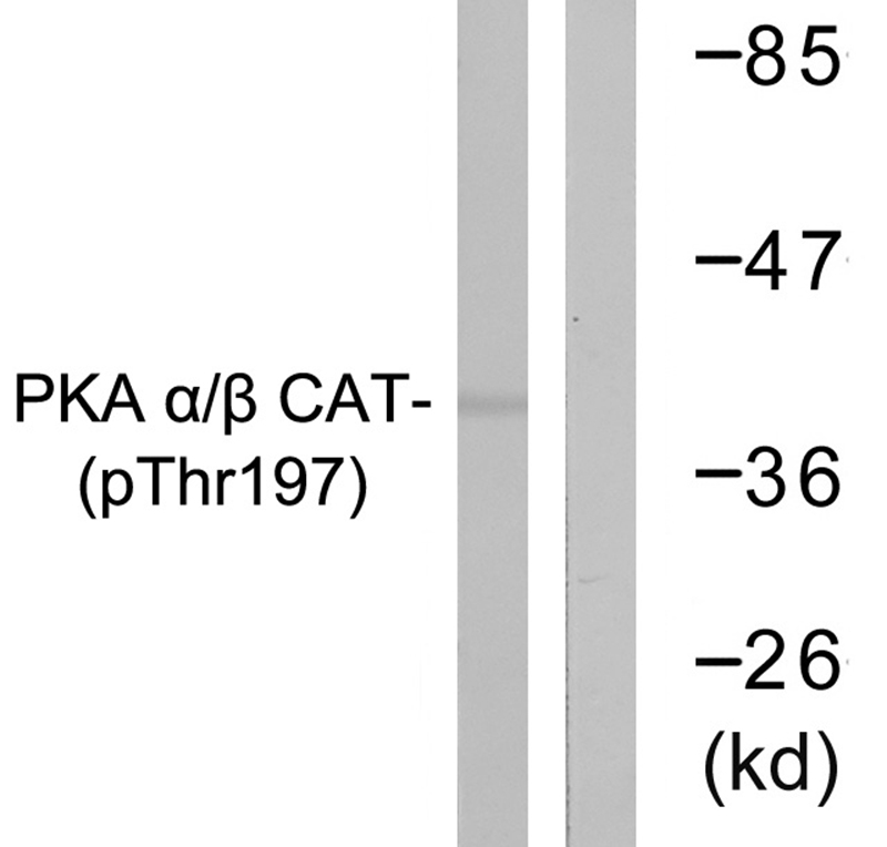 PKA α/β CAT (Phospho-Thr197)