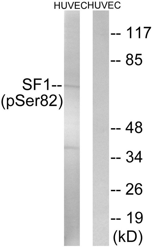 SF1 (Phospho-Ser82)