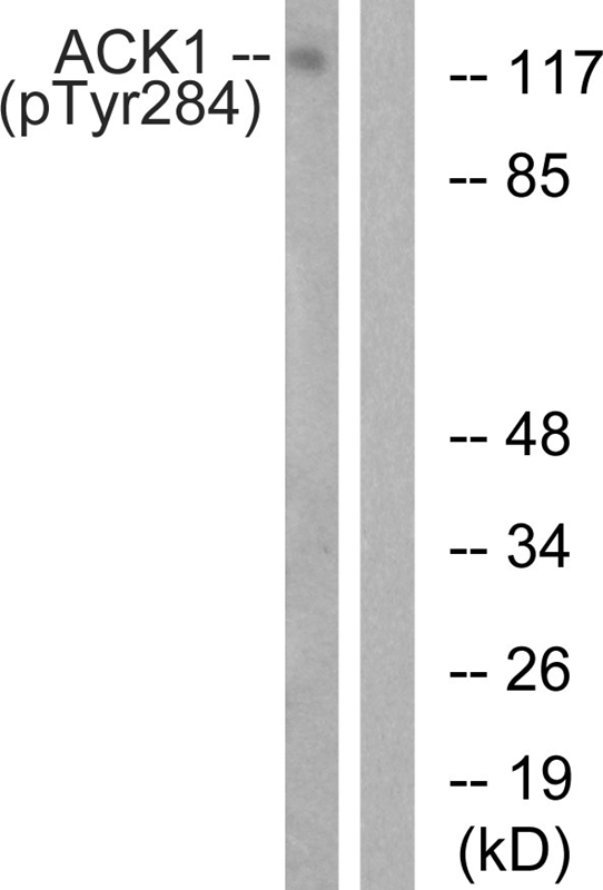 ACK1 (Phospho-Tyr284)