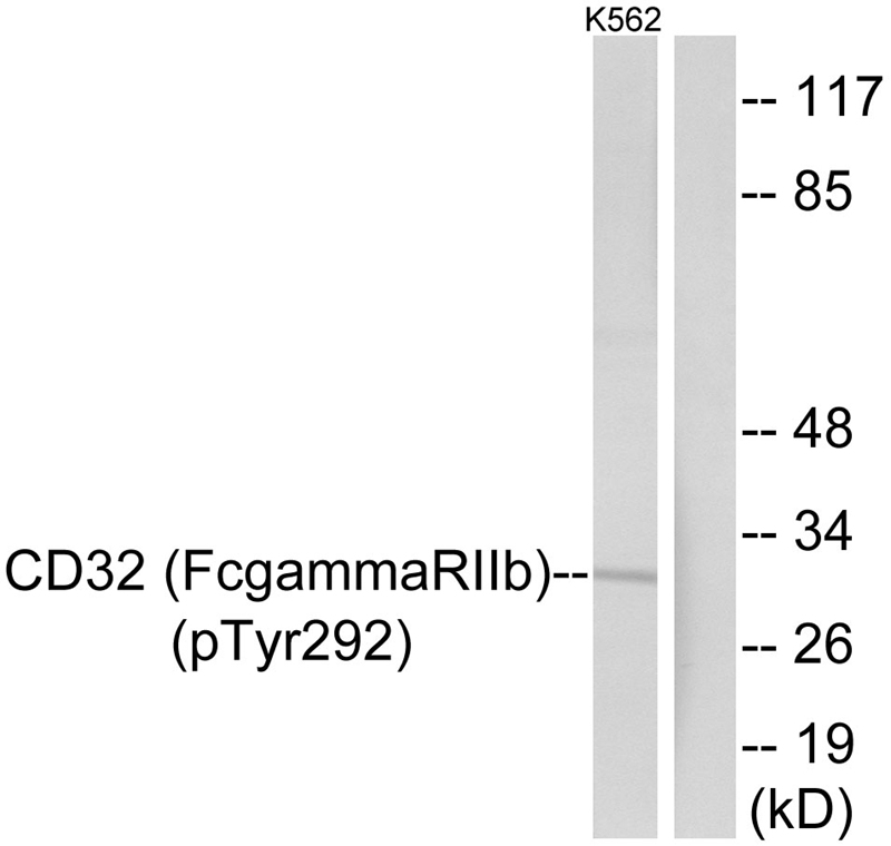 CD32 (Phospho-Tyr292)