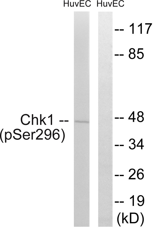 Chk1 (Phospho-Ser296)