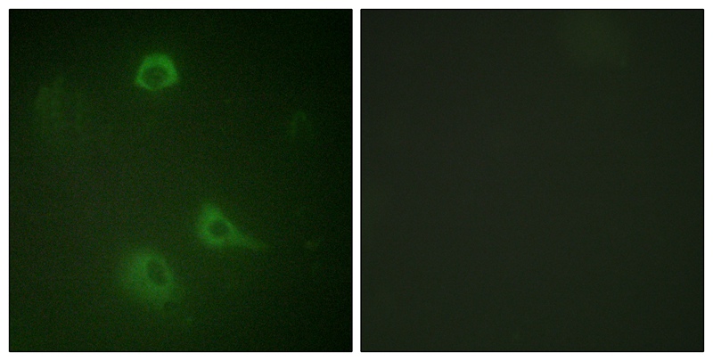 NMDAR1 (Phospho-Ser890)