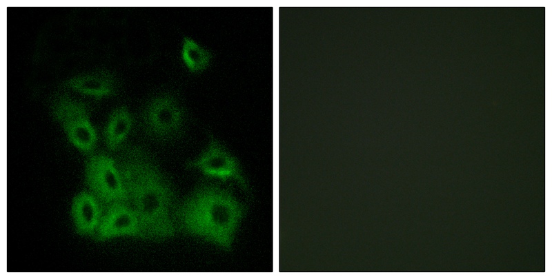Bax (Phospho-Thr167)
