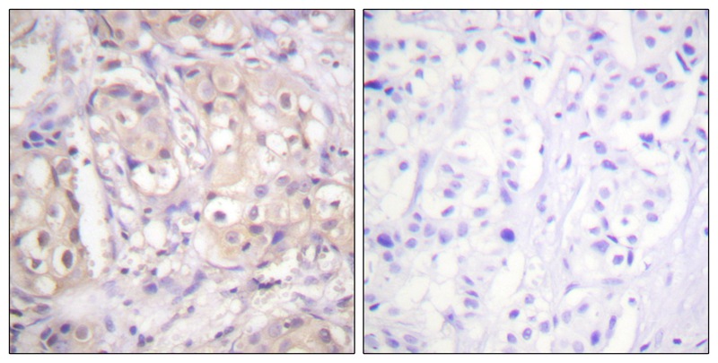 B-RAF (Phospho-Thr599)