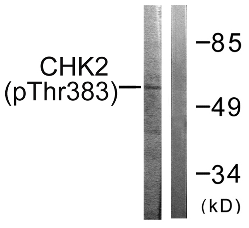 Chk2 (Phospho-Thr383)