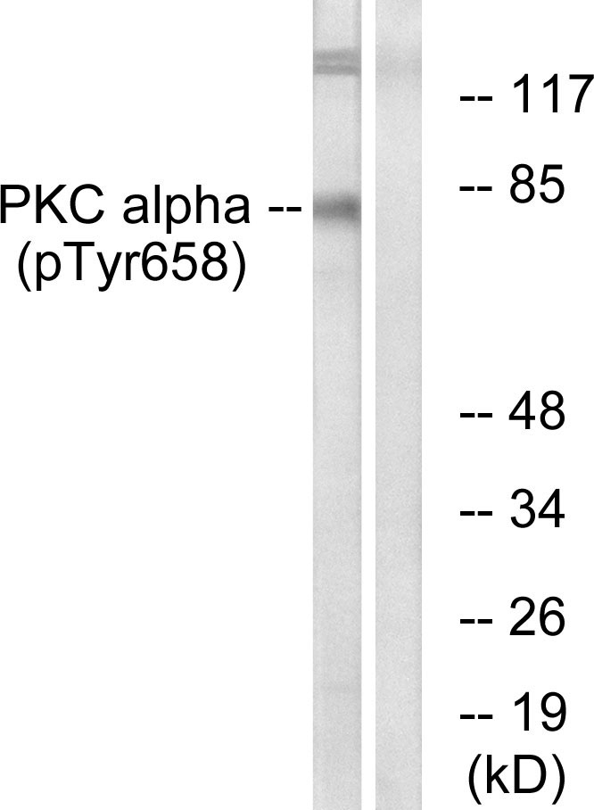 PKC α (Phospho-Tyr658)