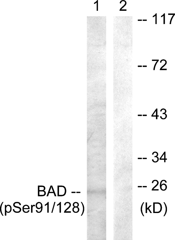 BAD (Phospho-Ser91/128)