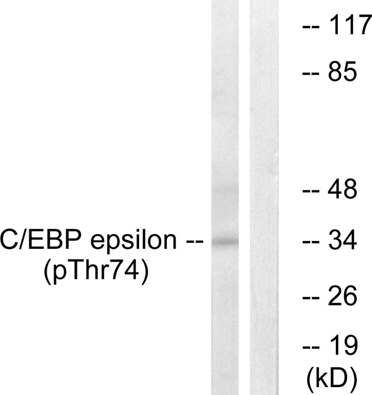 C/EBP-ε (Phospho-Thr74)