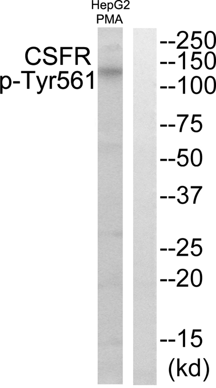 CSFR (Phospho-Tyr561)