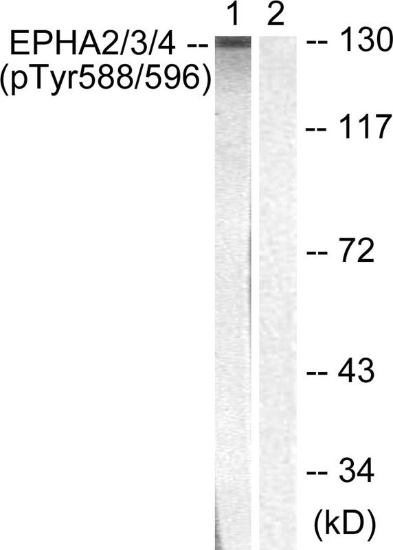 EPHA2/3/4 (Phospho-Tyr588/596)