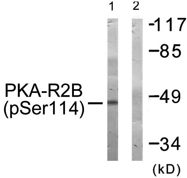 PKA-R2β (Phospho-Ser114)