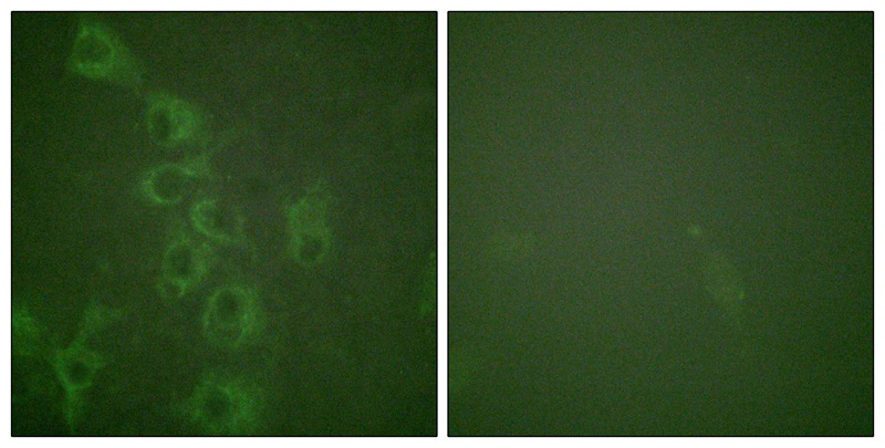 Histamine H1 Receptor (Phospho-Ser398)