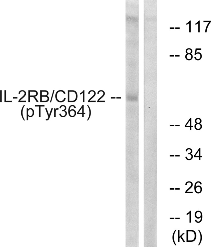 IL-2Rβ/CD122 (Phospho-Tyr364)