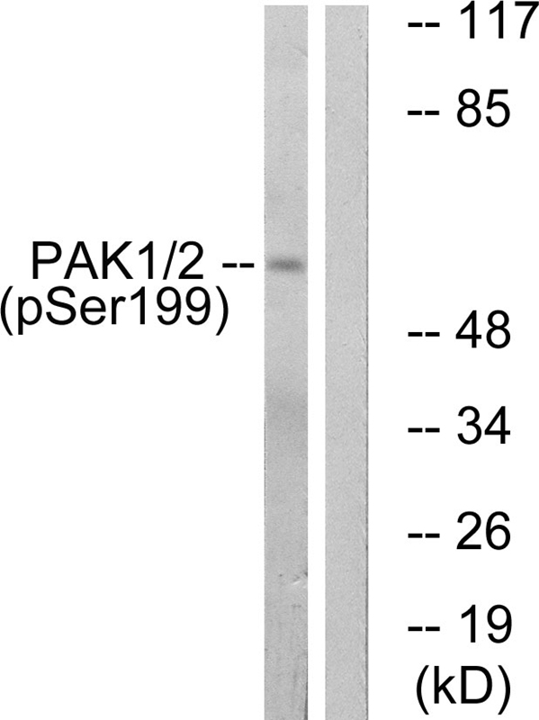 PAK1 (Phospho-Ser199)