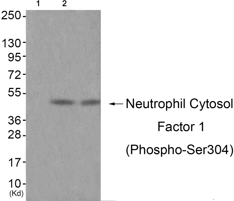 Neutrophil Cytosol Factor 1 (Phospho-Ser304)