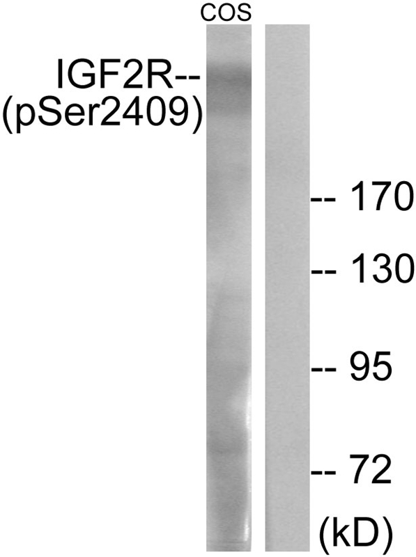 IGF2R (Phospho-Ser2409)