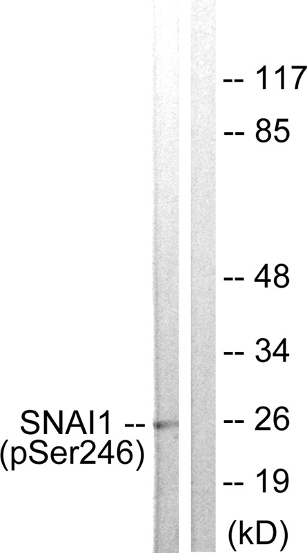 SNAI1 (Phospho-Ser246)