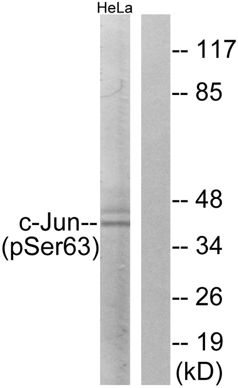 c-Jun (Phospho-Ser63)