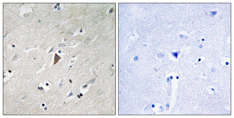 PDK1 (Phospho-Tyr9)