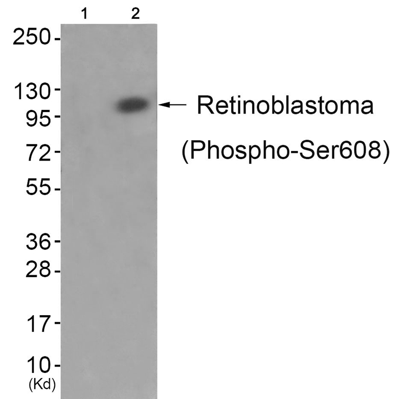 Retinoblastoma (Phospho-Ser608)