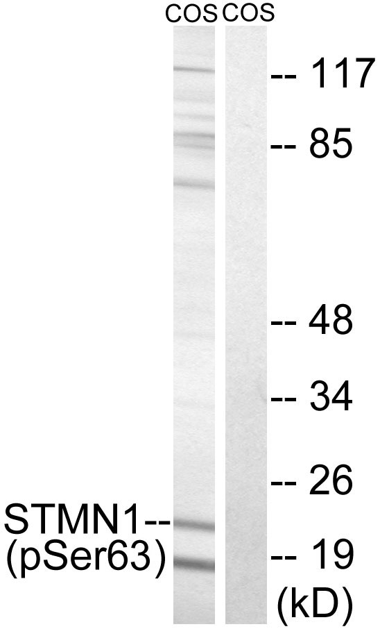 STMN1 (Phospho-Ser63)