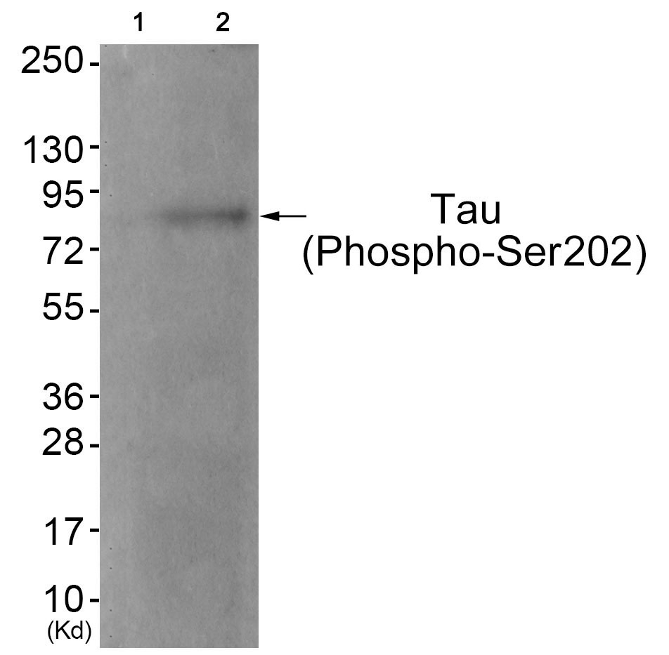 Tau (Phospho-Ser202)