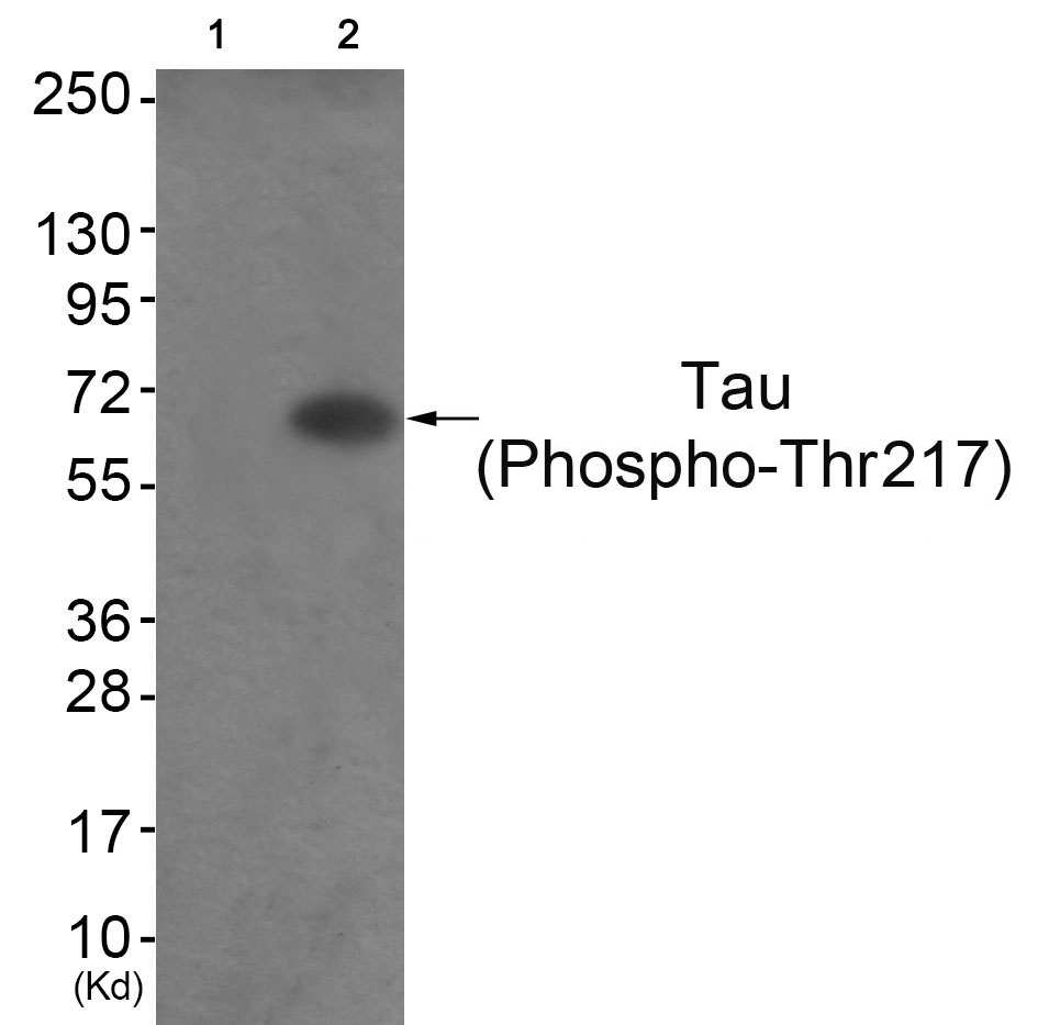 Tau (Phospho-Thr217)
