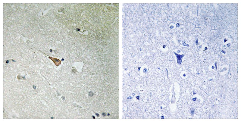 ALK (Phospho-Tyr1096)