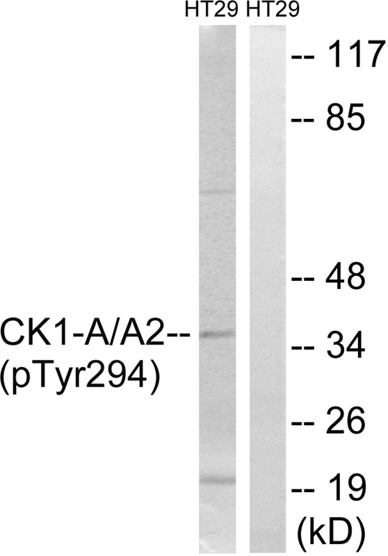 CK-1α (Phospho-Tyr294)