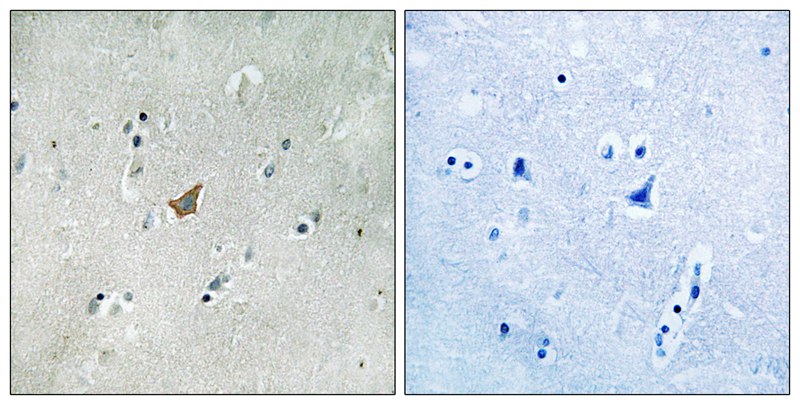 EPHA3/4/5 (Phospho-Tyr779/833)