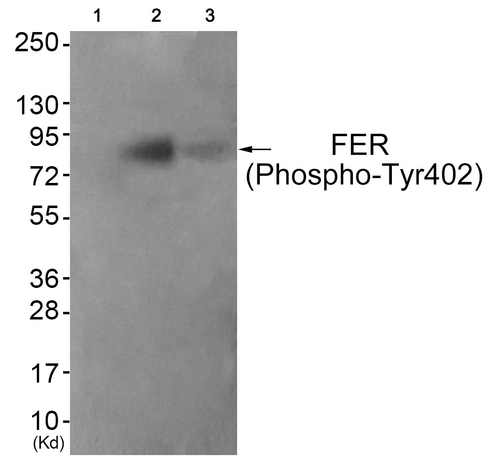 FER (Phospho-Tyr402)