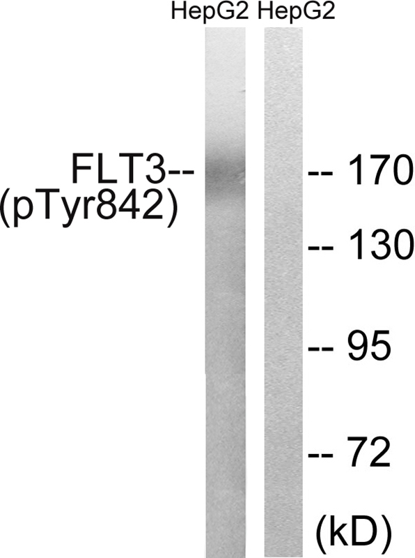 FLT3 (Phospho-Tyr842)