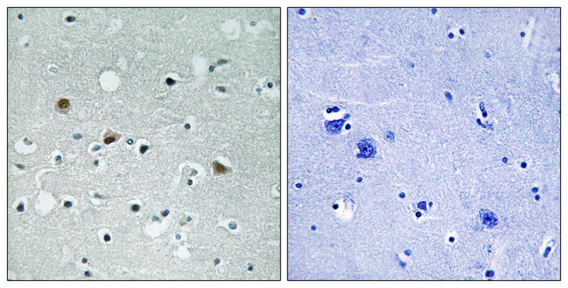 LATS1/2 (Phospho-Thr1079/1041)