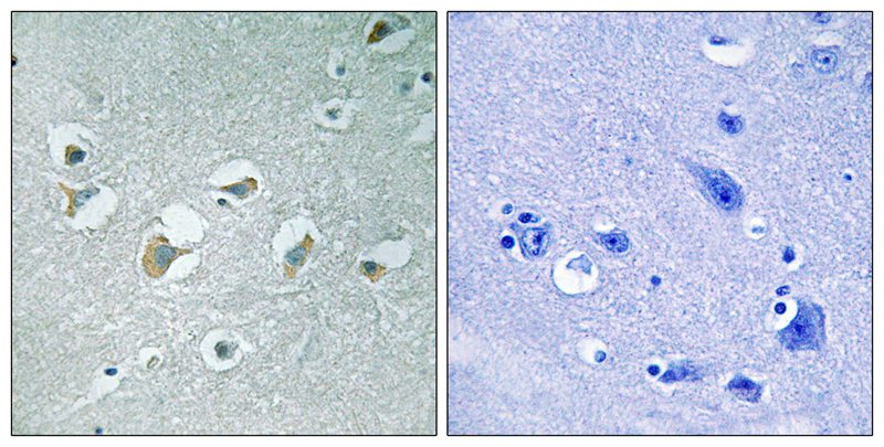 MLK1/2 (Phospho-Thr312/266)