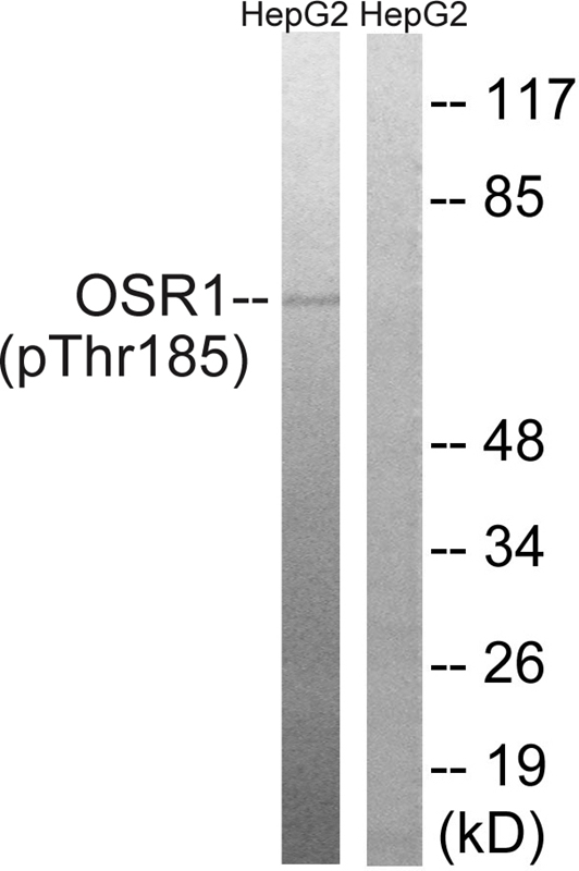 OSR1 (Phospho-Thr185)