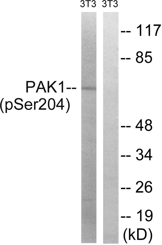 PAK1 (Phospho-Ser204)