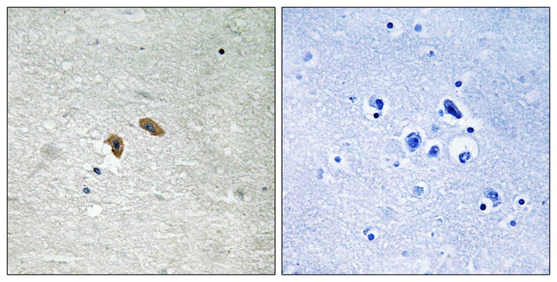 C-RAF (Phospho-Thr269)