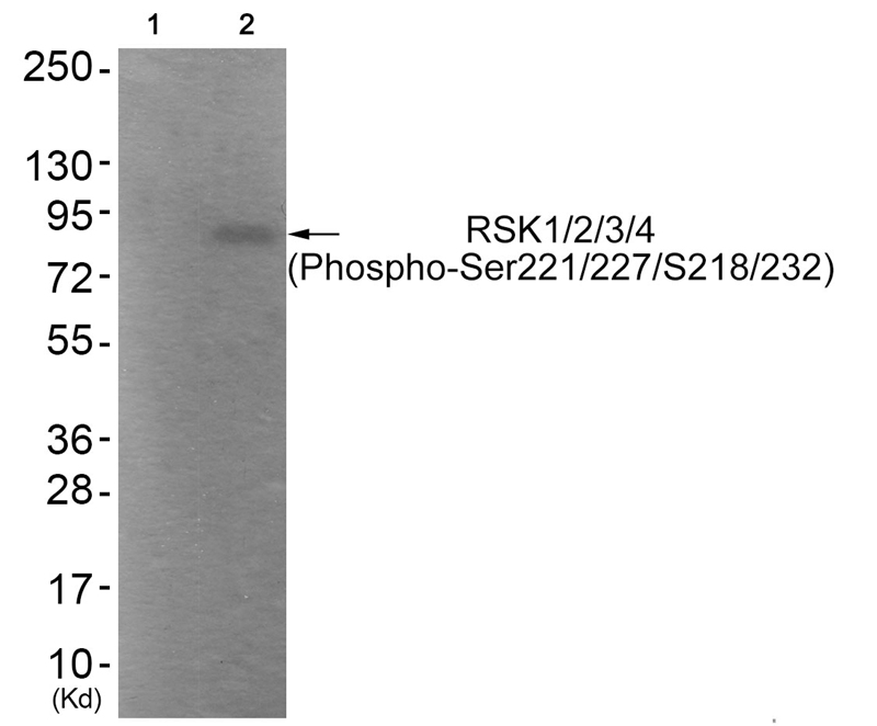 RSK1/2/3/4 (Phospho-Ser221/227/S218/232)