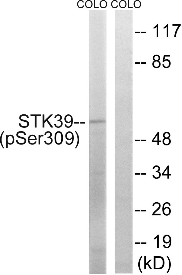 STK39 (Phospho-Ser309)
