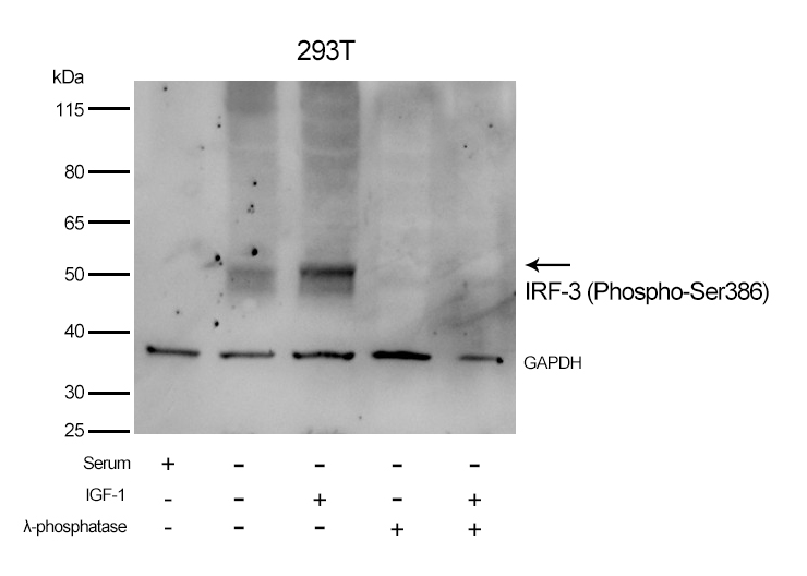 IRF-3 (Phospho-Ser386)