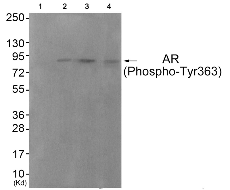 Androgen Receptor (Phospho-Tyr363)
