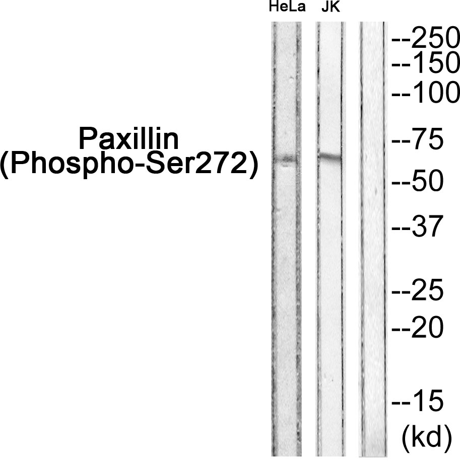 Paxillin (Phospho-Ser272)