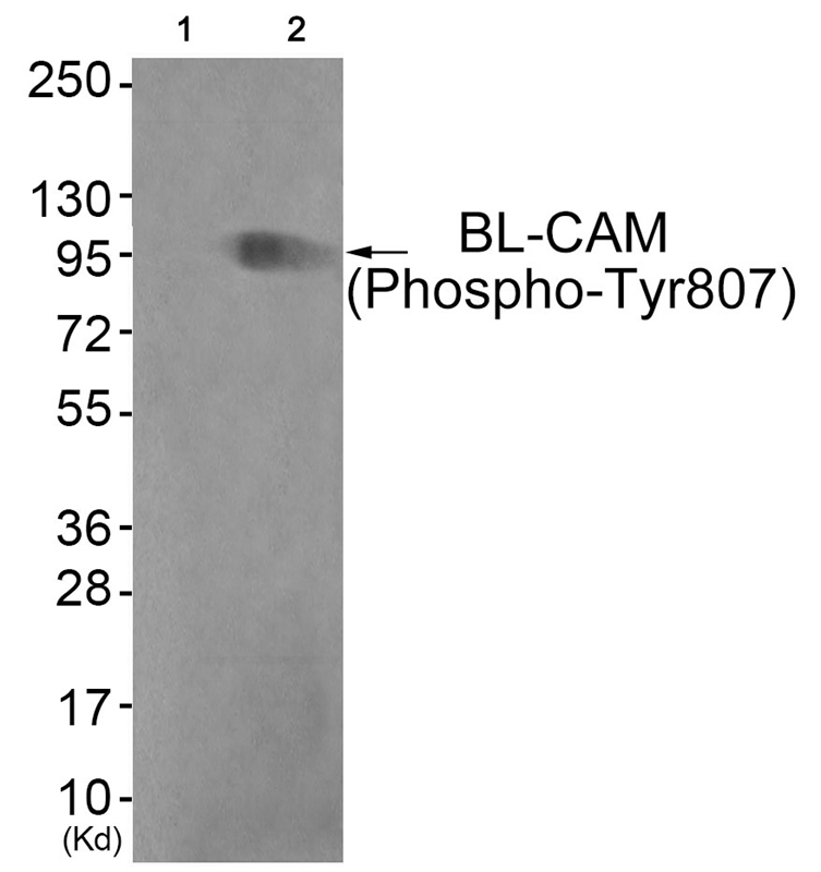 BL-CAM (Phospho-Tyr807)