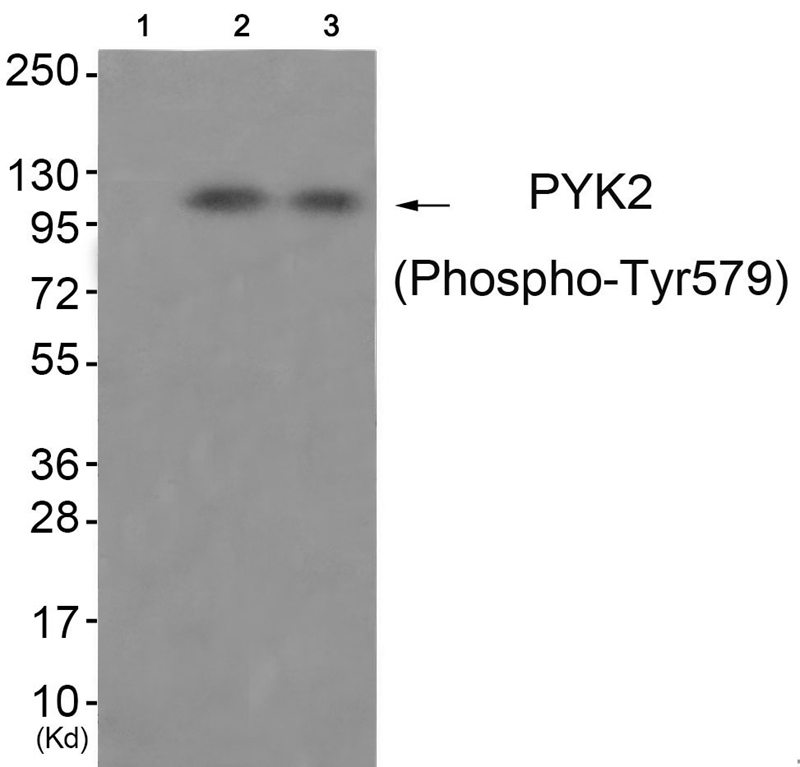 PYK2 (Phospho-Tyr579)