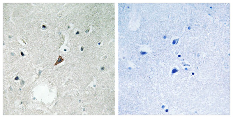 Rabbit Polyclonal Antibody to PYK2 (Phospho-Tyr579)