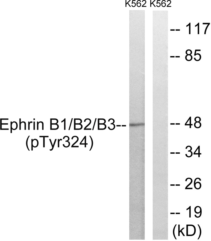 Ephrin B1/B2/B3 (phospho Y324/Y311/Y318)