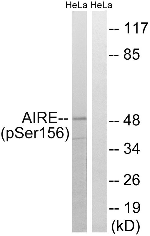 AIRE (Phospho-Ser156)