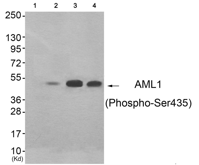 AML1 (Phospho-Ser435)